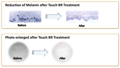 Miracle Touch BR Skin Booster